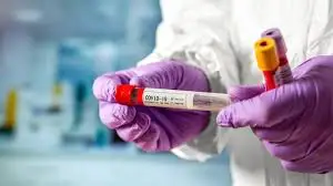 Коронавирус жұқтырғандардың саны күрт өсті