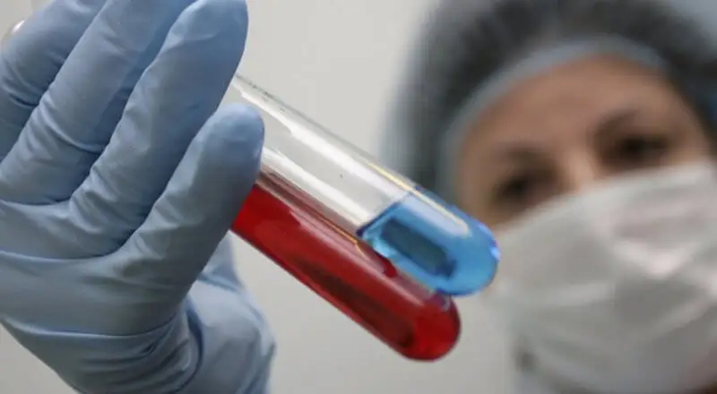 Шымкентте  сібір жарасын жұқтырғандар анықталды (видео)