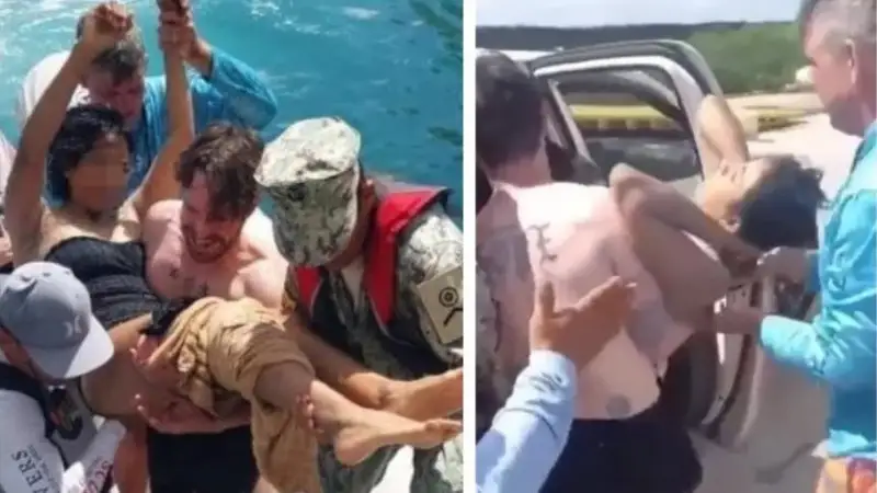 5 ота жасалып, 100 жіппен тіккен. Әйел акула шабуылынан аман қалды (видео)