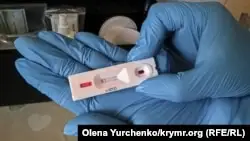 БҚО-да науқастардың коронавирусты қайдан жұқтырғанын зерттейді