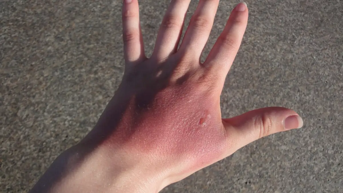 Барабинскіде жыныстық қатынас