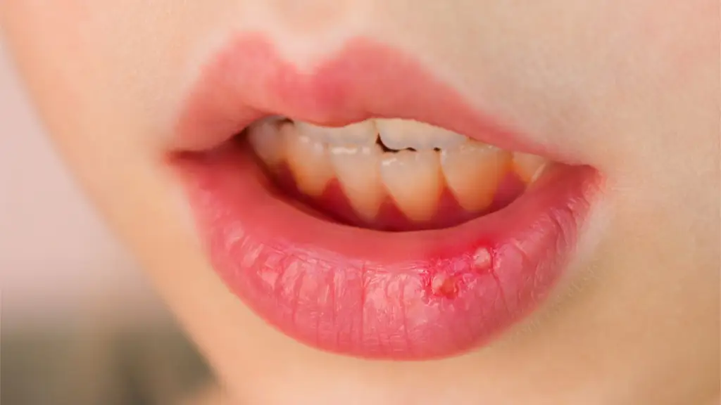 Беренис Марло секс