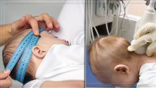 черепное давлени