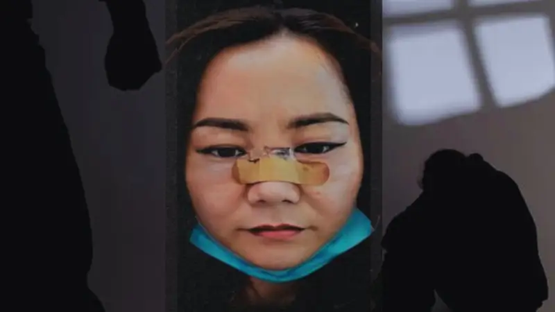  «Арызыңды алмасаң өлтіремін»: Экс-күйеуінен 9 жыл бойы таяқ жеп келе жатқан әйелдің хикаясы